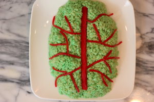 Zombie Brains Rice Krispie Treats